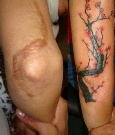 hình xăm che sẹo lồi ở khuỷu tay