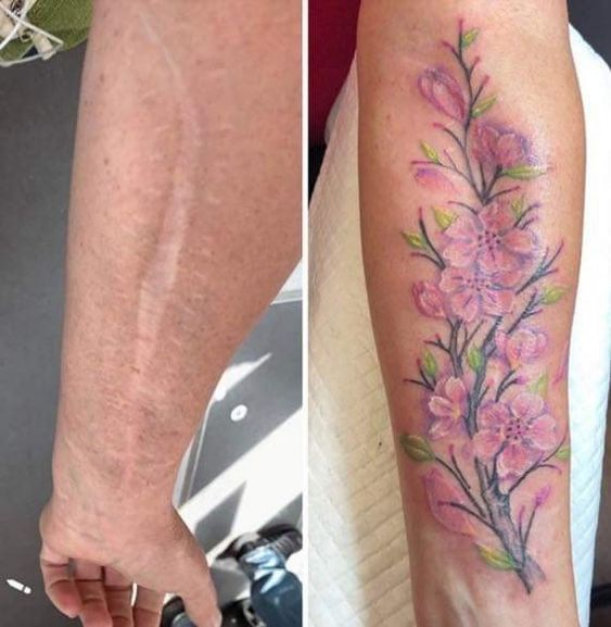 hình xăm che sẹo lõm cực đẹp