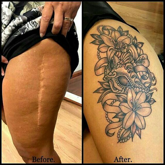 hình xăm che sẹo lõm trên đùi nữ