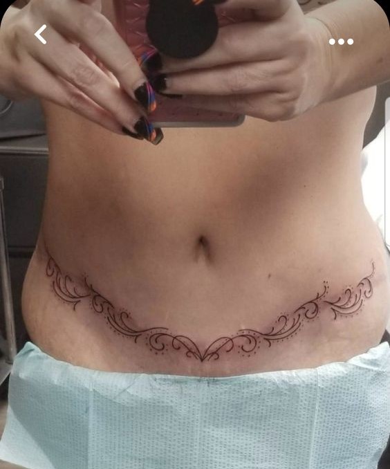 hình xăm che sẹo mổ đẻ