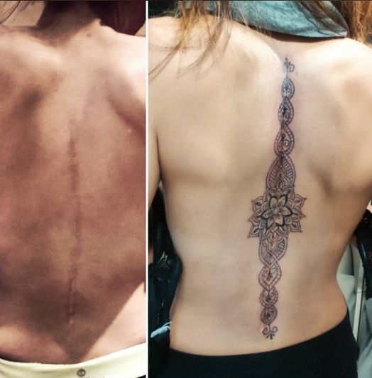 hình xăm che sẹo ở lưng