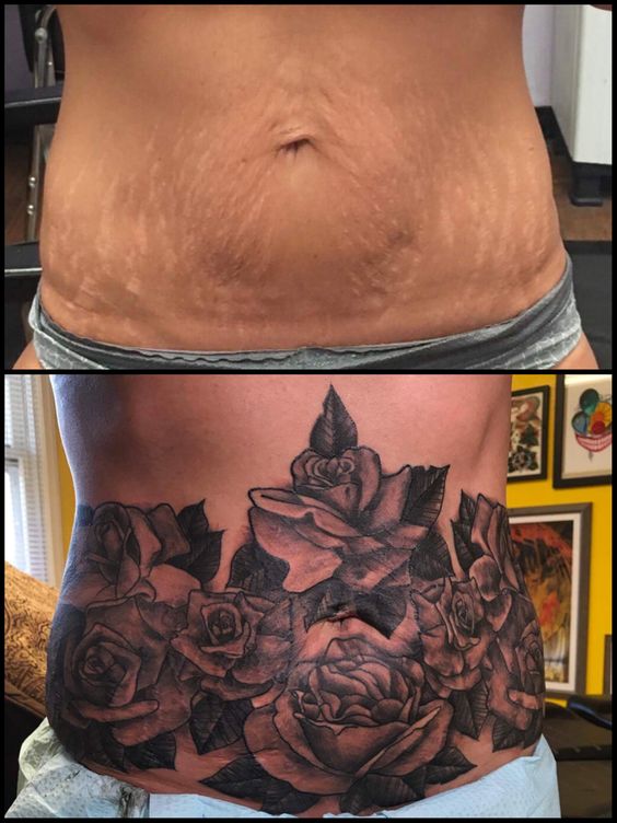 hình xăm che vết rạn bụng