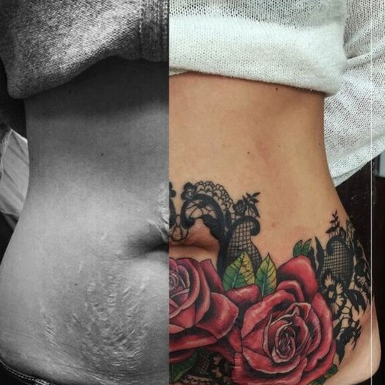 mẫu tattoo che vết rạn bụng