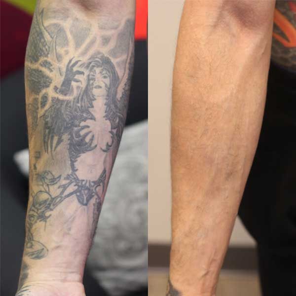 mẫu xăm che gân tay